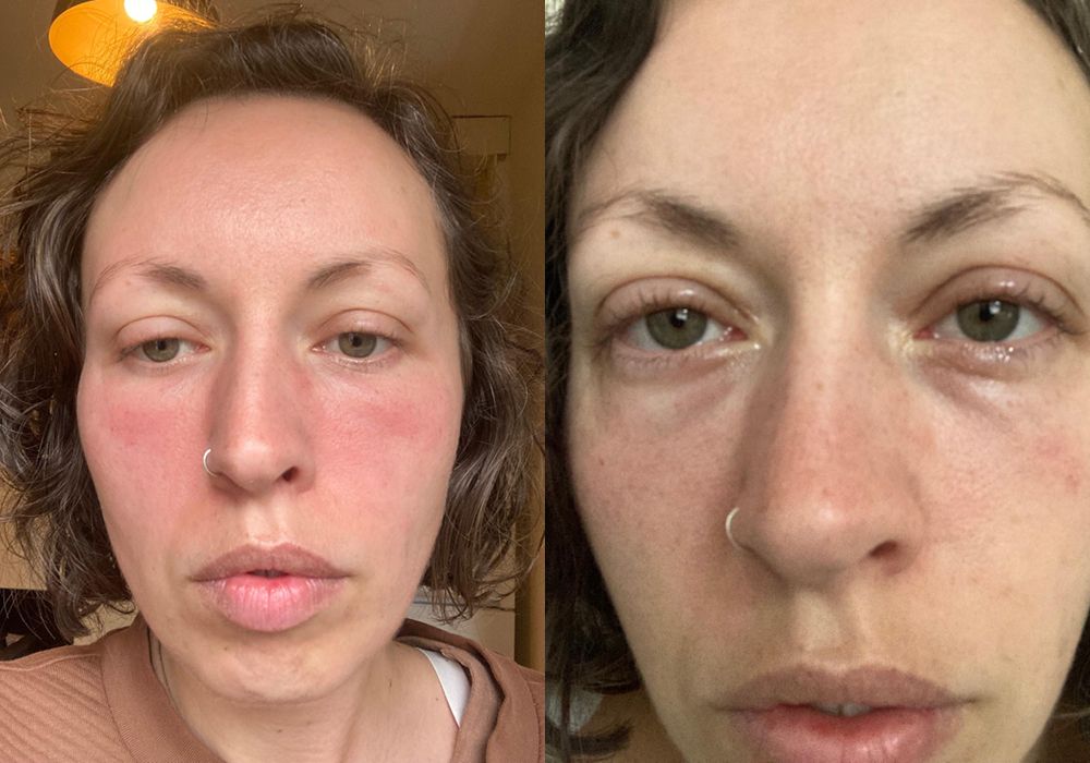 My ME/CFS and Long COVID Recovery Story: How Mind-Body Healing and Nervous System Regulation Restored My Health